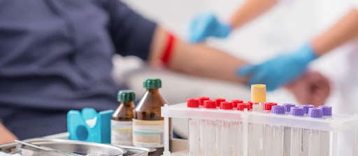 blood test lab in baton rouge, la